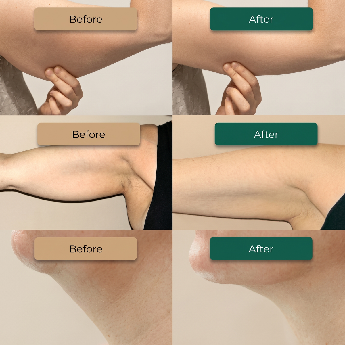 Lymphatic Drainage